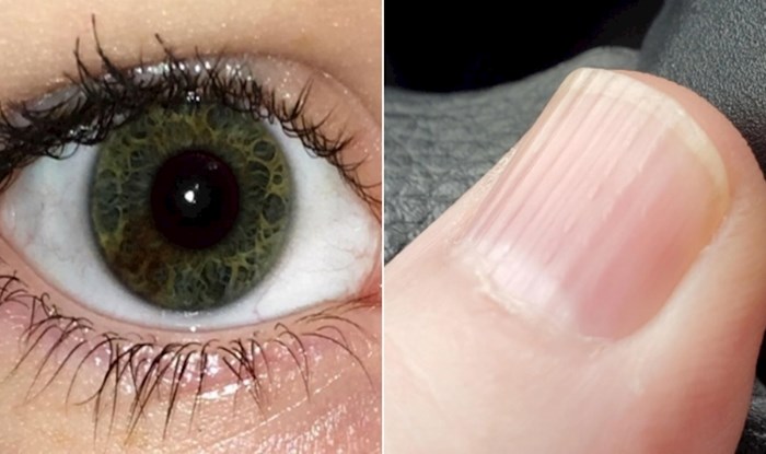 14 ljudi čija tijela imaju zanimljive i nesvakidašnje osobine