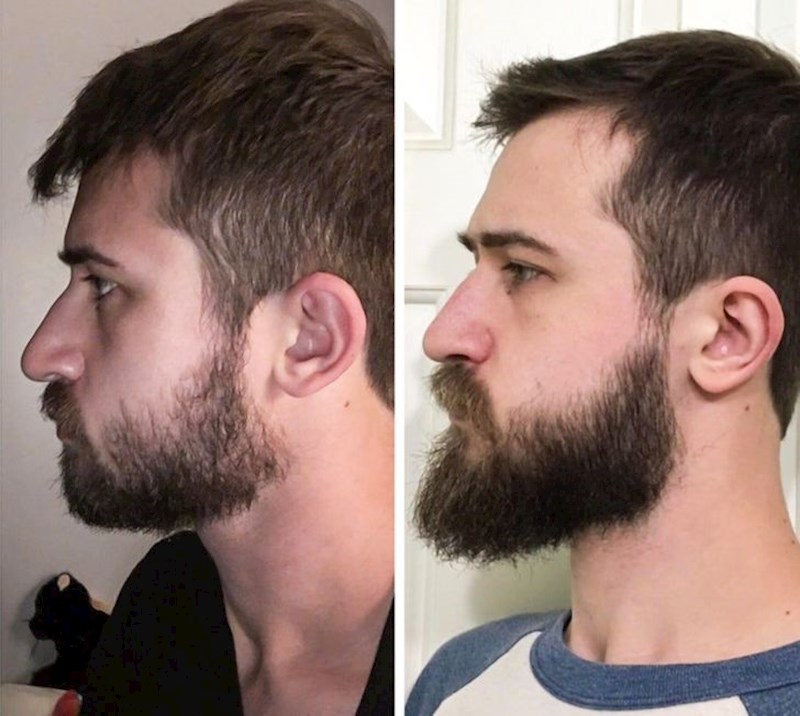 7. Priroda ga nije obdarila sa snažnom linijom čeljusti, pa ju je napravio sam