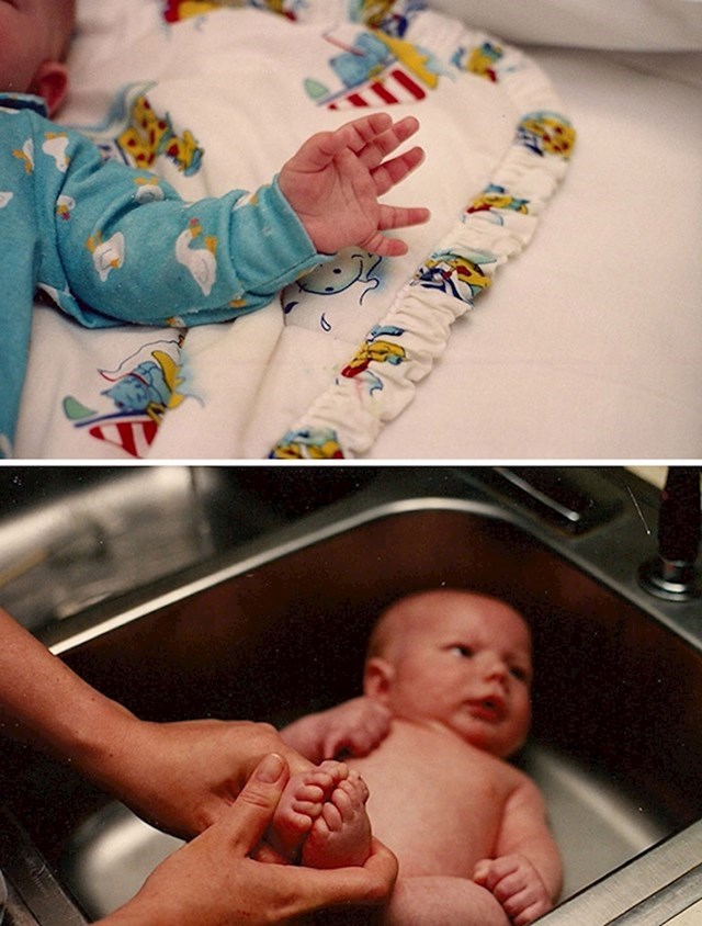 3. "Rođena sam sa šest prstiju na rukama i nogama. Ovo su moje fotke kad sam bila beba."