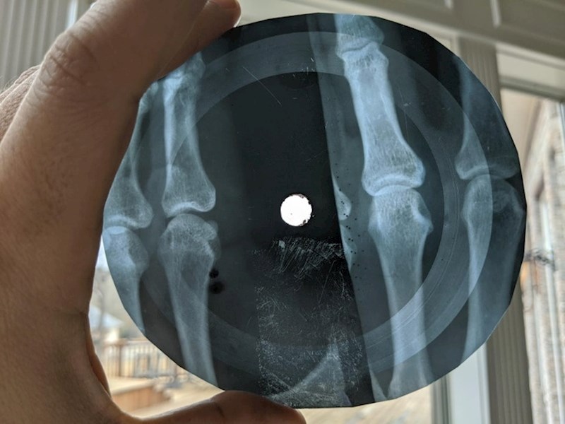 11. Zapadna glazba nije bila dostupna u Sovjetskom Savezu, pa su ljudi razvili metodu za "prepisivanje" glazbe na rendgenski film.