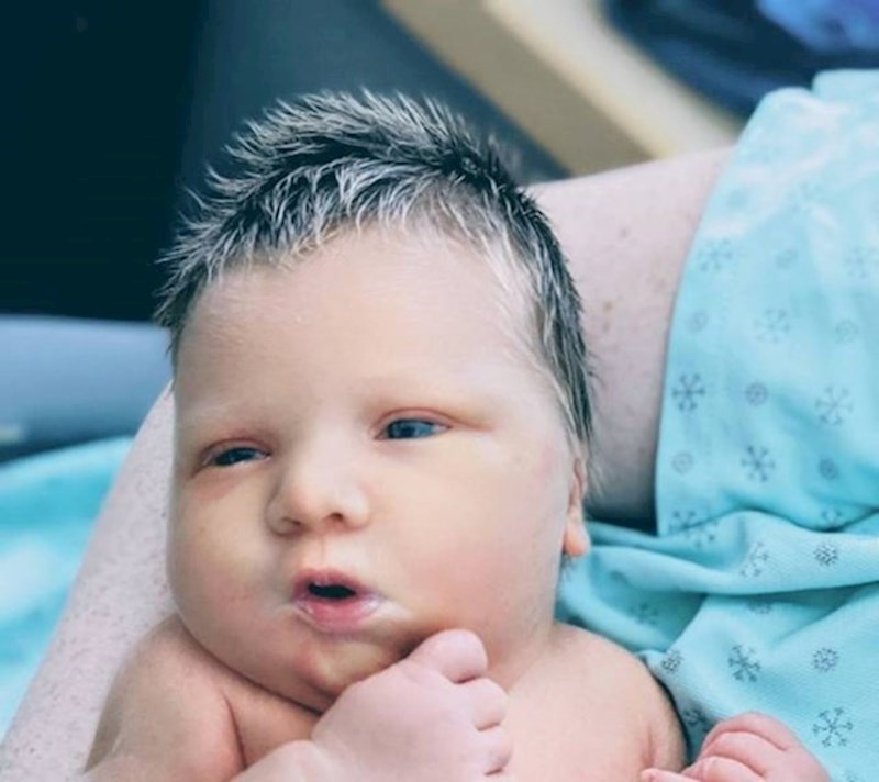 6. Beba koja je rođena s "pramenovima".