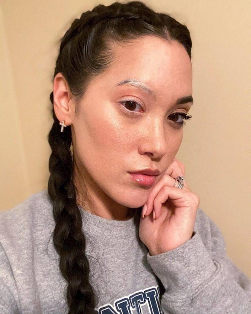 Zanimljiva depigmentacija.