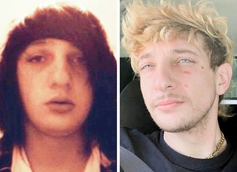 2. Na lijevoj slici ima 16, a na desnoj 28 godina. Potpuno je procvao!