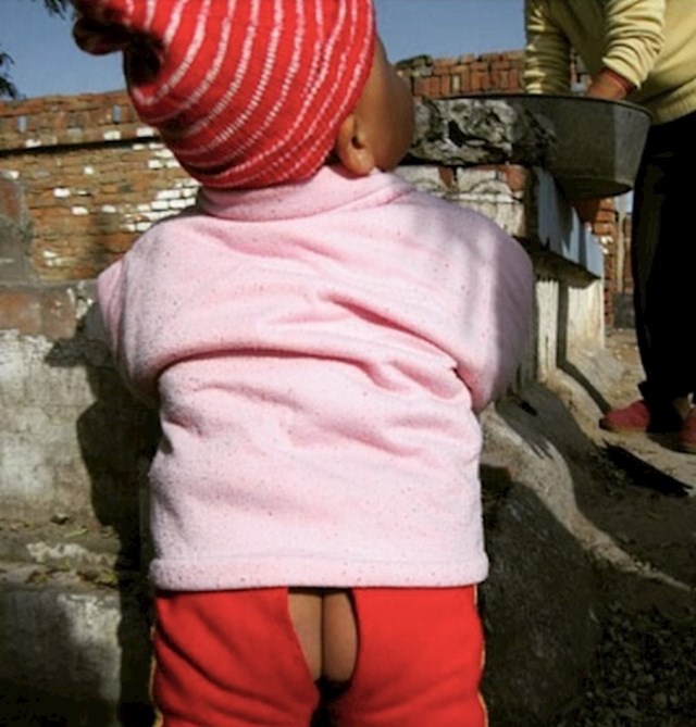 13. Neka djeca u Kini imaju ovakve otvore na guzi, da se mogu olakšati u svakom trenutku bez da zaprljaju odjeću.