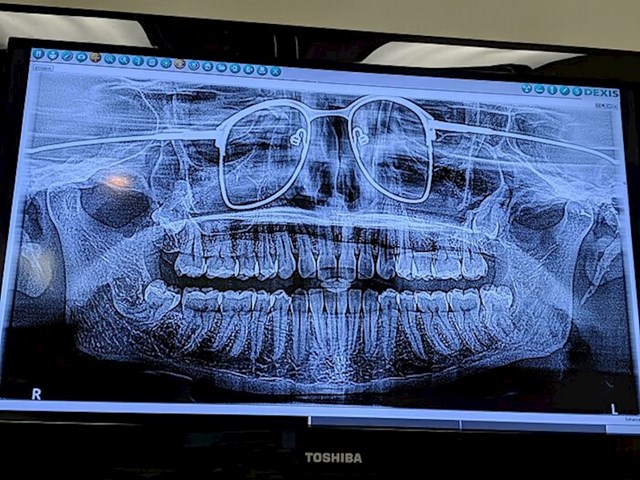 7. Doktor mu je zaboravio napomenuti da mora skinuti naočale za rendgensku snimku