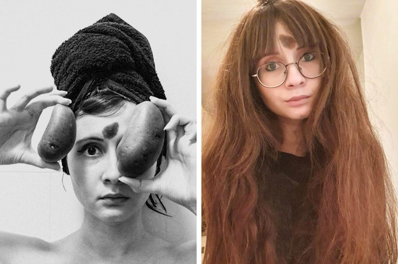 "Oduvijek sam skrivala madež na svojem čelu. No više se ne sramim."