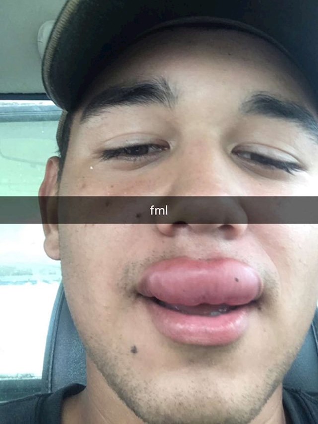 7.