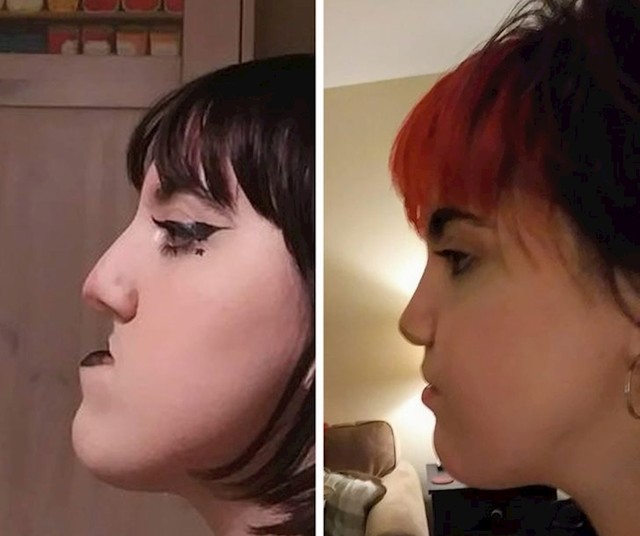 5.