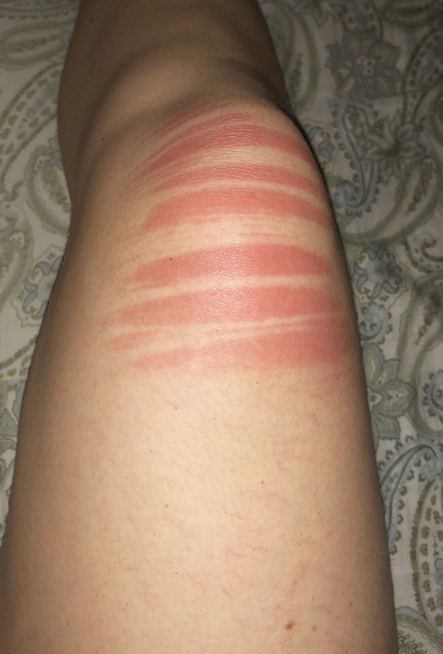 21.
