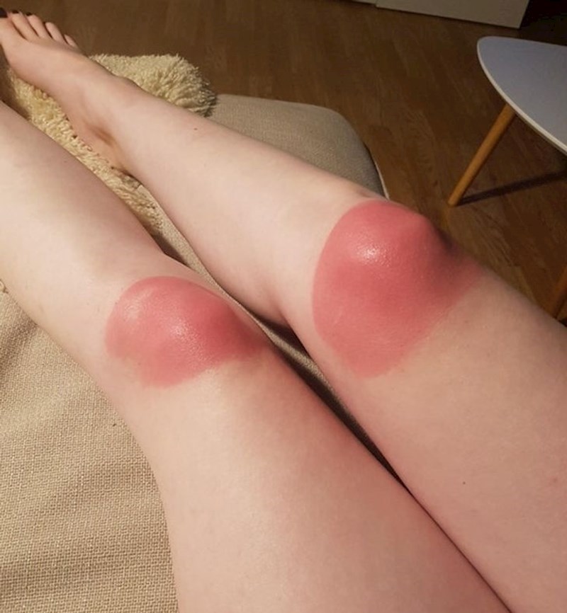 15. Obukla je traperice s rupama po jakom suncu