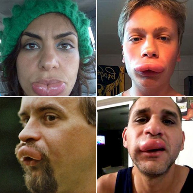 16.