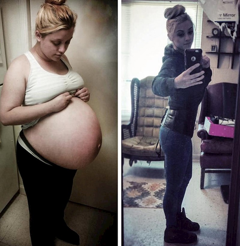 15. "Nakon što sam rodila blizance."