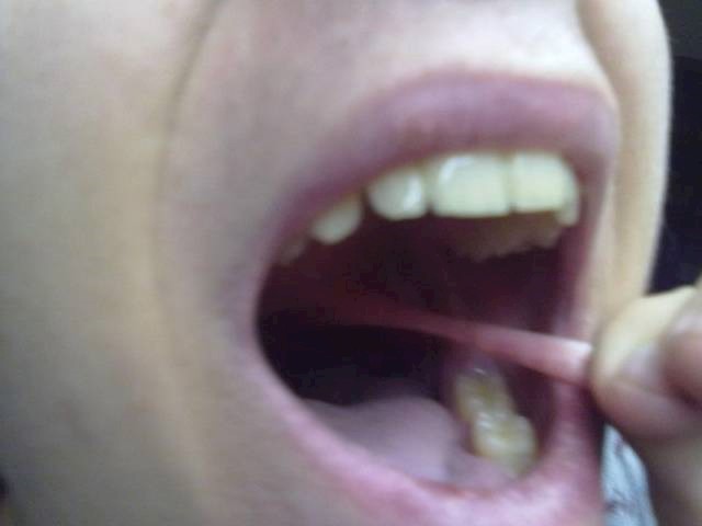 6.