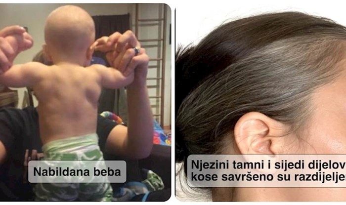 10 ljudi koji su pokazali da nas naše tijelo može iznenaditi više od bilo kakve magije