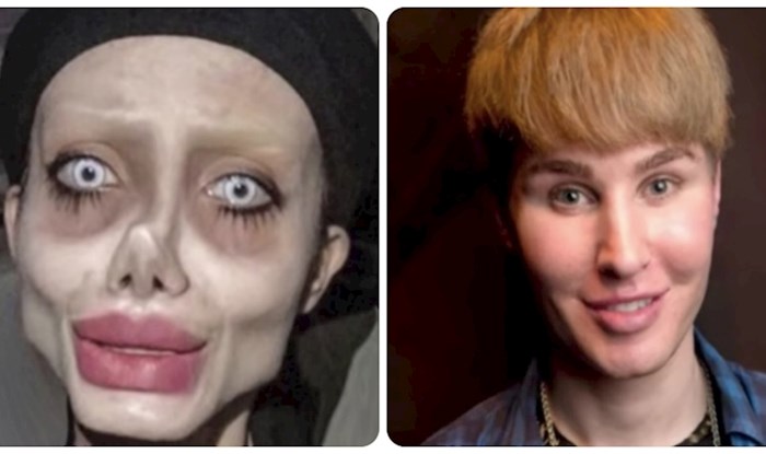 10 ljudi koji su "malo" pretjerali s plastičnim operacijama kako bi nalikovali na poznate face