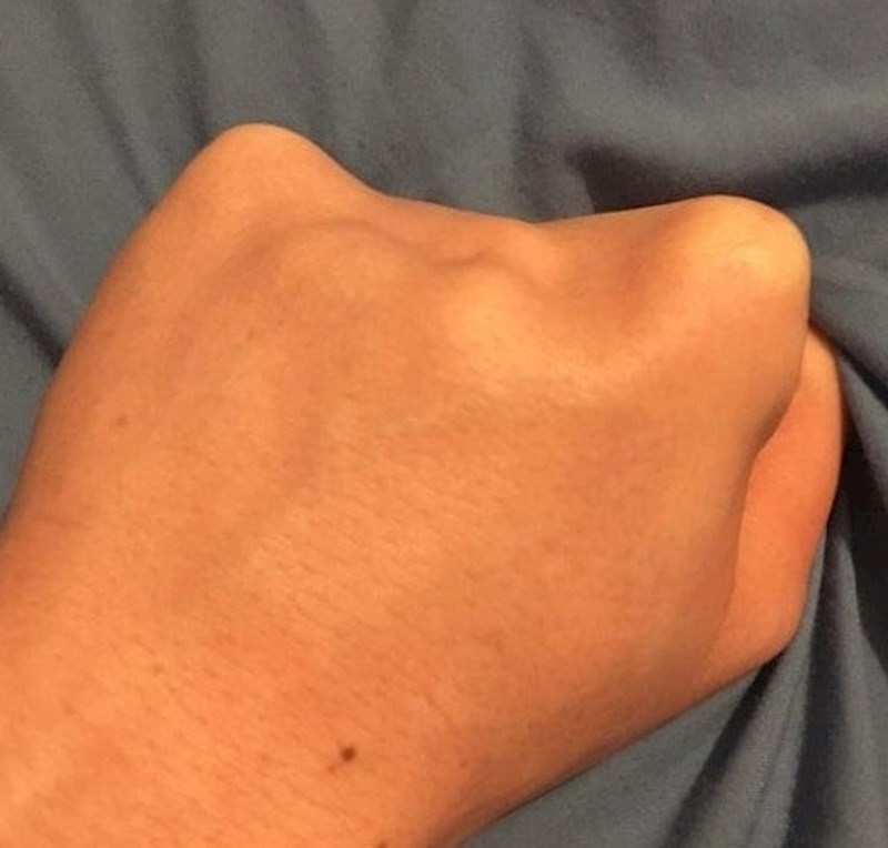 15.  “Moji genetski potisnuti zglobovi na lijevoj ruci”