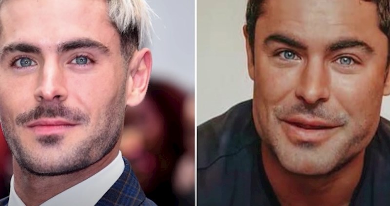 VIDEO 10 poznatih osoba koje su pretjerale s operacijama i pretvorile se u čistu plastiku