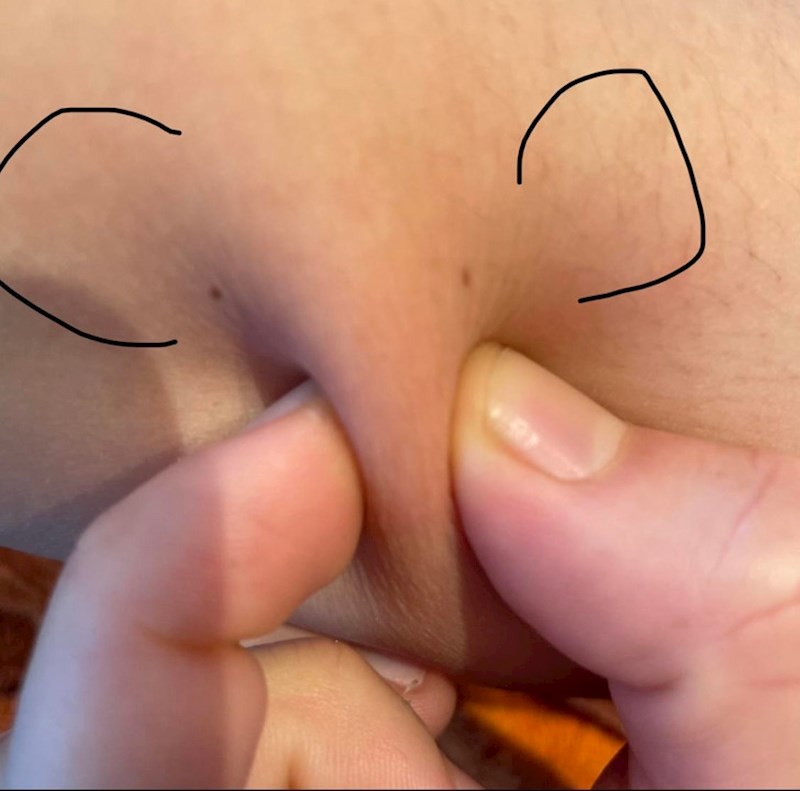 5. Ako imate dva madeža jedan pokraj drugoga, možete napraviti slonića na svojoj koži