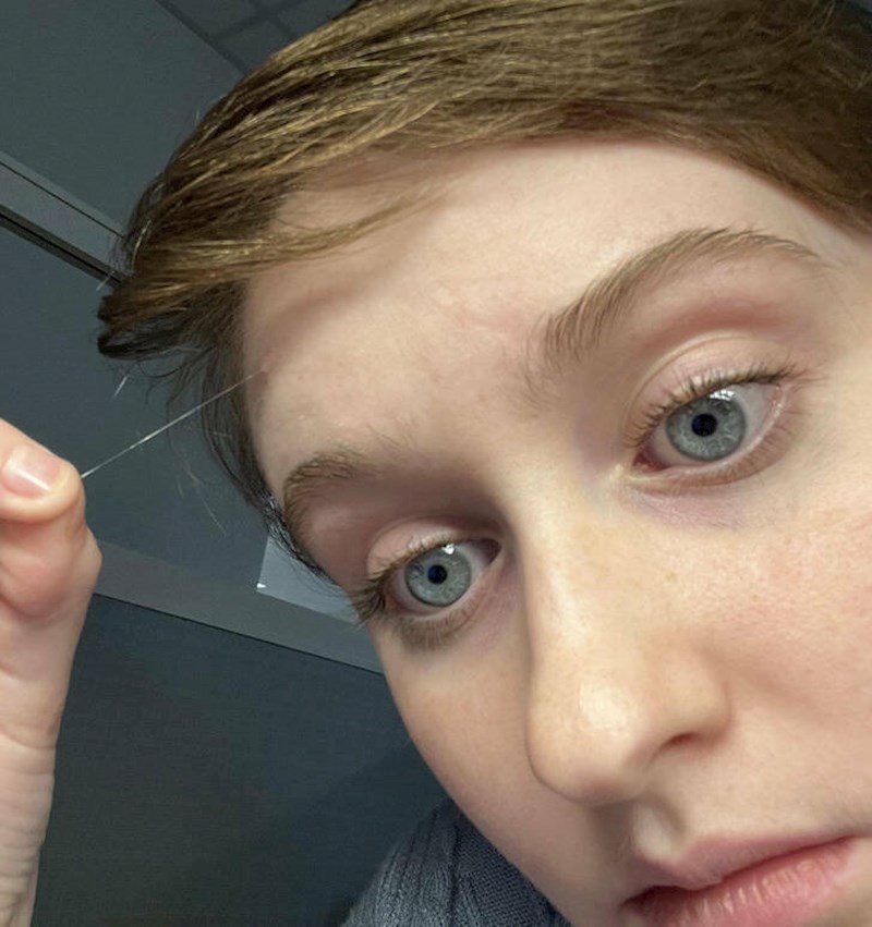 1. Ima neobično dugu bijelu dlaku na čelu