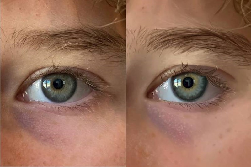 10. "Moja kći prvo je fotkala svoje oko, pa napravila ovu genijalnu realističnu sliku pomoću svojeg tableta."