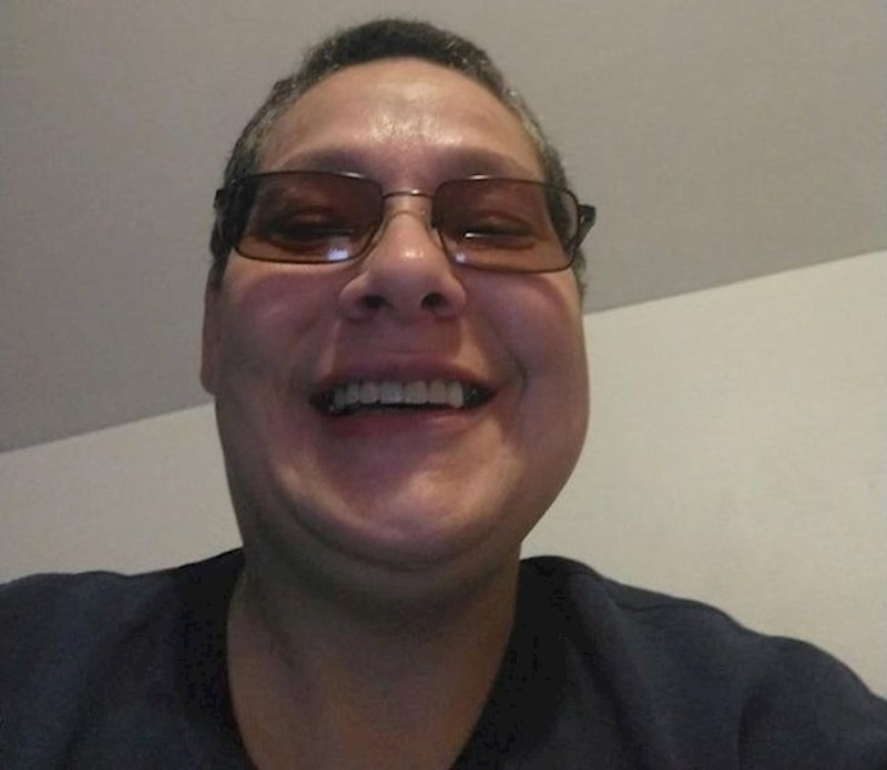 3. Godinama se nisam smijala zbog svojih ružnih zubi. Nakopon sam ih popravila i sad uživam u svakom osmjehu.