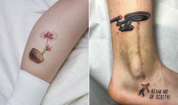 20+ genijalnih tetovaža koje su nečije madeže i ožiljke pretvorile u umjetnička djela