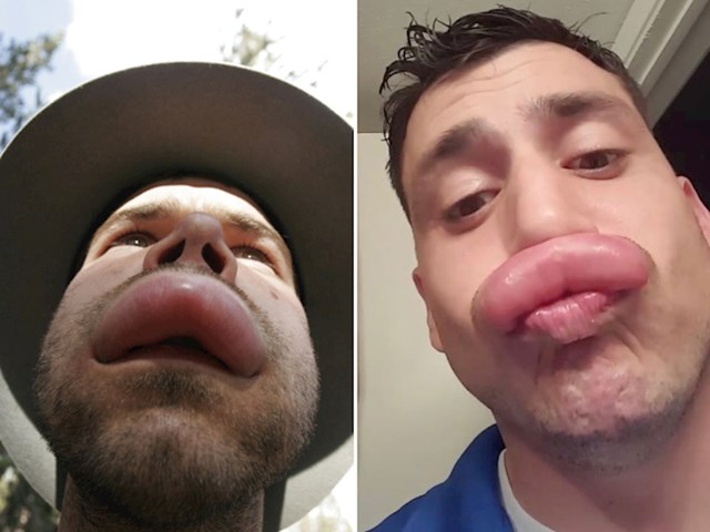 5.