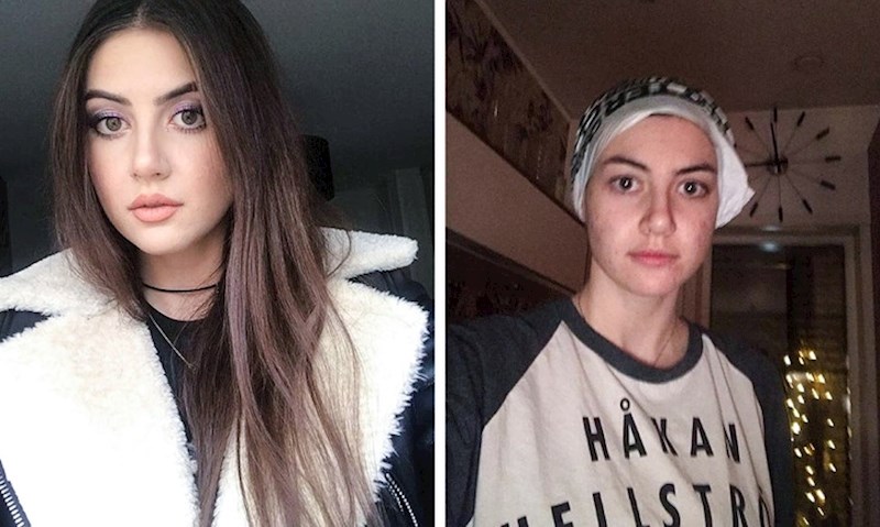 Ova cura sama je odlučila pokazati koliko je Instagram nerealan što se standarda ljepote tiče.