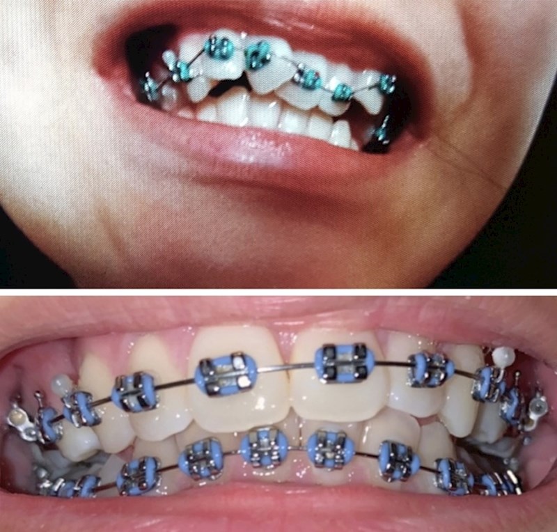 "Rezultat u svega par mjeseci."