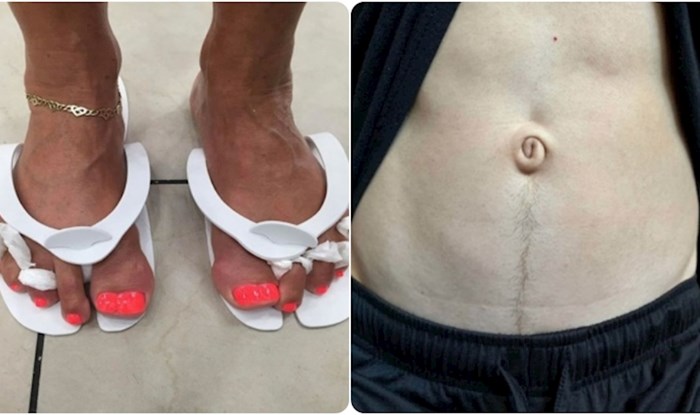 17 ljudi s čijim se fizičkim karakteristikama priroda malo poigrala