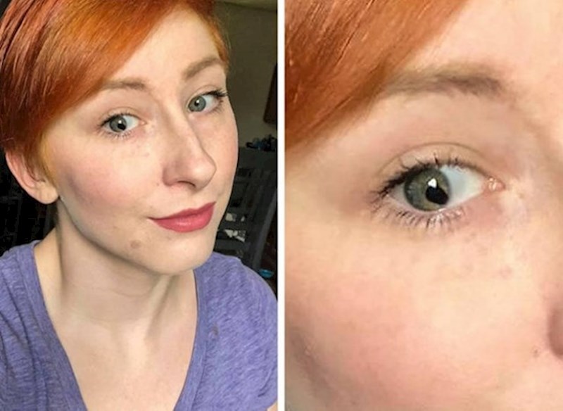 9.  Malo "razlivena" zjenica