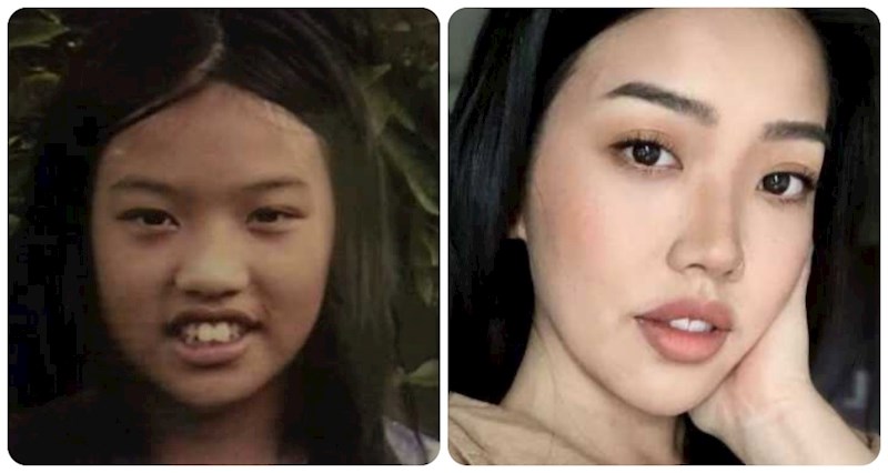 15 "ružnih pačića" koji su odrasli u izuzetno privlačne  ljude