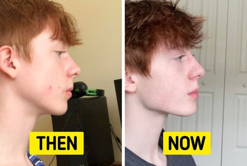 Nakon operacije čeljusti koju je oduvijek priželjkivao