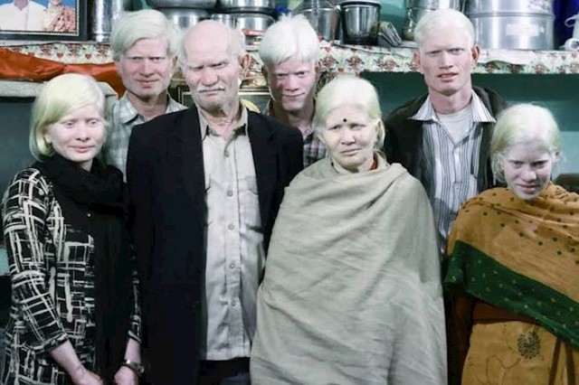 14. Albino obitelj iz Indije