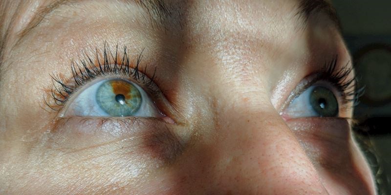 3. Ima različite boje očiju, a u lijevom oku ima madež.