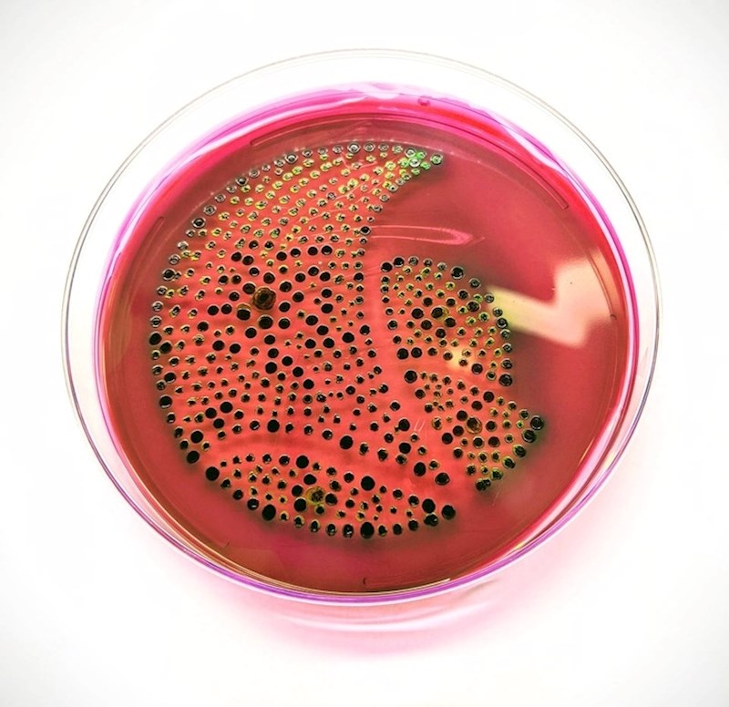 20. Netko je uzgojio ovo u petrijevoj zdjelici.