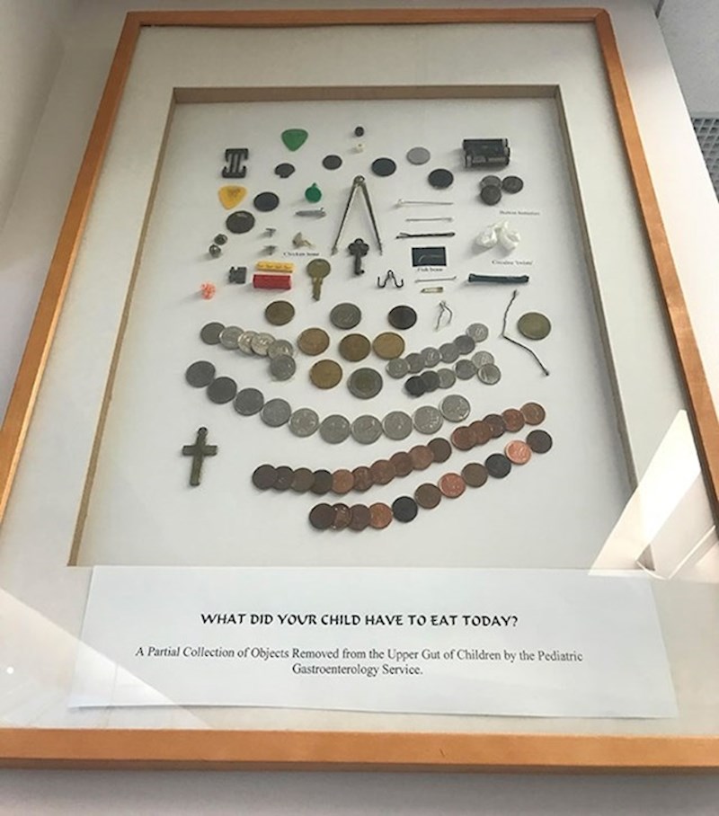 Doktor skuplja predmete koje su djeca progutala