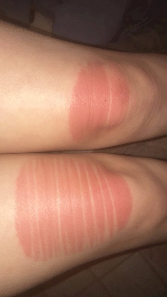 20.