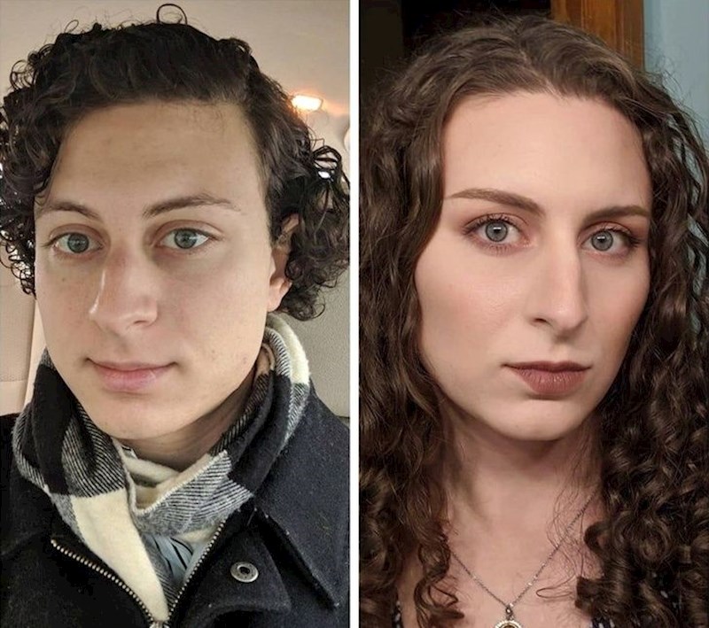 2. "Nakon tri godine hormonalne terapije."