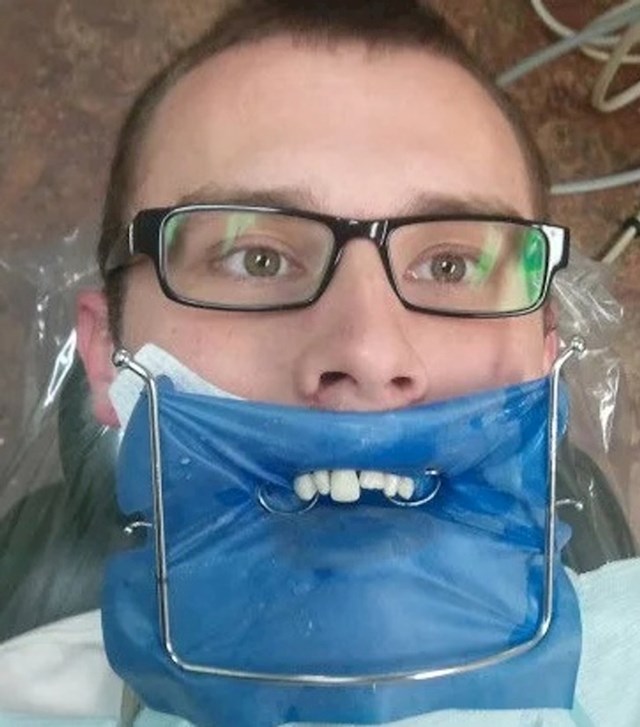 1. Zamolio je zubara da ga fotka usred procedure