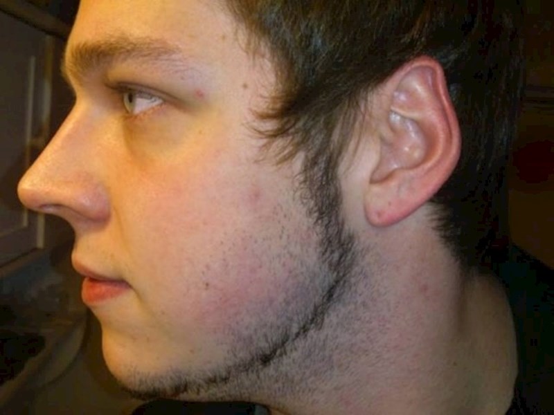 11. Rođen je s vilenjačkim ušima