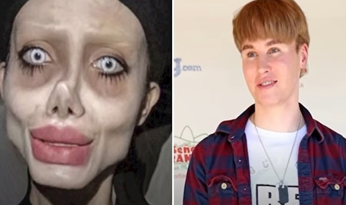 VIDEO Ljudi koji su "malo" pretjerali s operacijama da nalikuju na poznate face