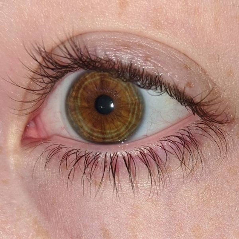 5. Ova zanimljiva šarenica.