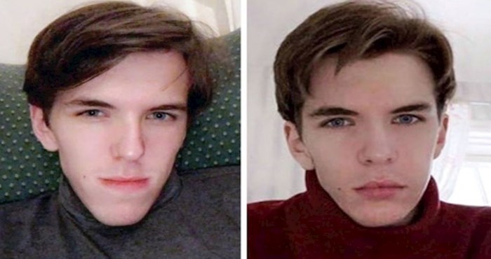 19 ljudi podijelili su fotke prije i poslije estetske operacije, rezultati su zapanjujući