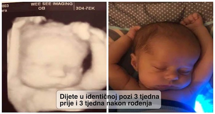 16 zabavnih usporednih fotografija koje su oduševile internet