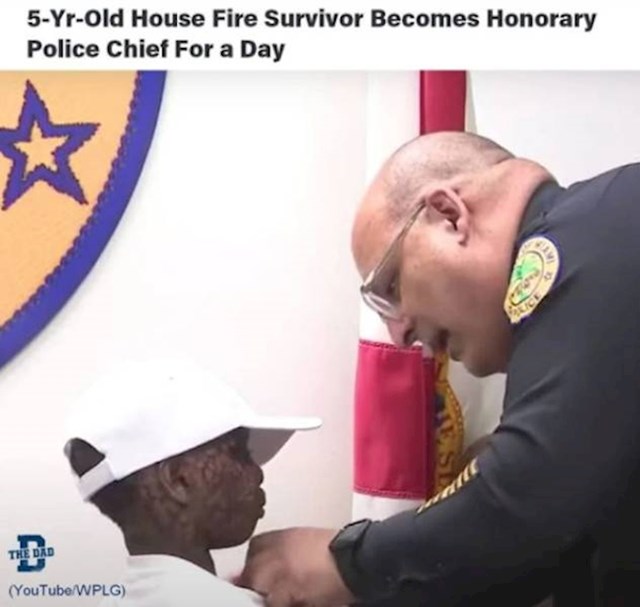 10. 5-godišnjak koji je preživio požar, uz teške opekline, postao je počasni načelnik policije na jedan dan.