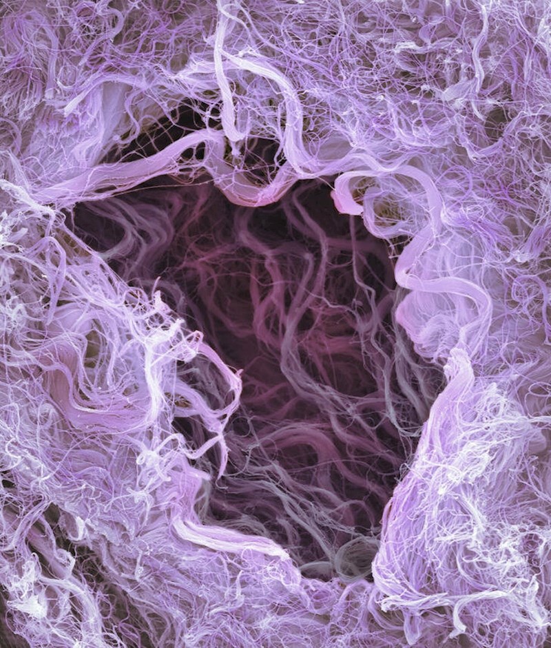 11. Snopovi kolagena u pupkovini