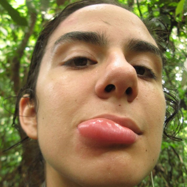 2.