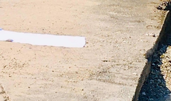 Tisuće ljudi smiju se ovom liku zbog onoga što ima na nogama dok se sunča na plaži