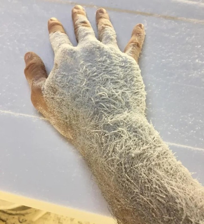 "Moja ruka nakon što sam oblikovao dasku za surfanje."